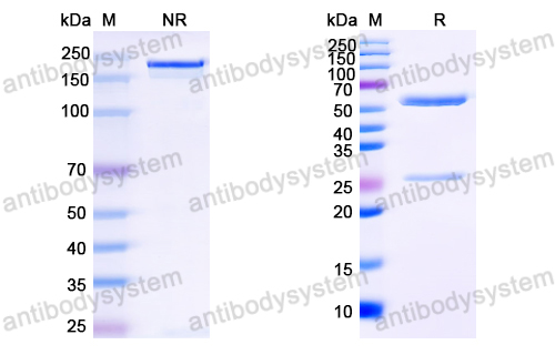 Anti-HCV NS1/gp68/gp70/Envelope glycoprotein E2 Antibody (HC84-1)