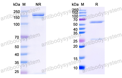 Anti-HCV NS1/gp68/gp70/Envelope glycoprotein E2 Antibody (HC84-27)