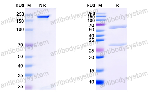 Anti-HCV NS1/gp68/gp70/Envelope glycoprotein E2 Antibody (AR3C)