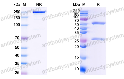 Anti-HCV NS1/gp68/gp70/Envelope glycoprotein E2 Antibody (HC84.26.5D)