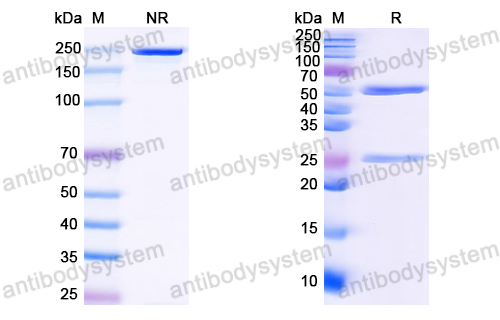 Anti-HCV NS1/gp68/gp70/Envelope glycoprotein E2 Antibody (MAb24)