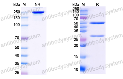 Anti-HCV NS1/gp68/gp70/Envelope glycoprotein E2 Antibody (HC84-26)