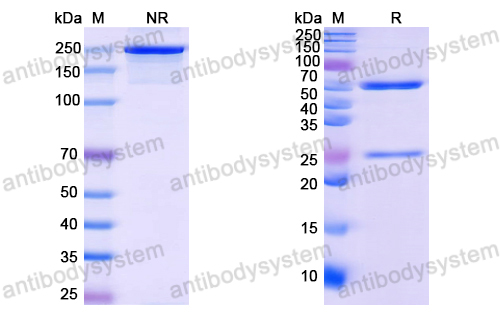 Anti-HCV NS1/gp68/gp70/Envelope glycoprotein E2 Antibody (D03)