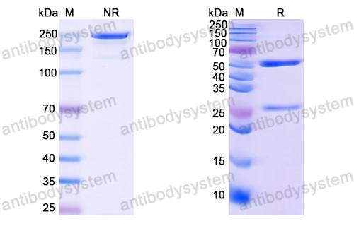 Anti-HCV NS1/gp68/gp70/Envelope glycoprotein E2 Antibody (C09)