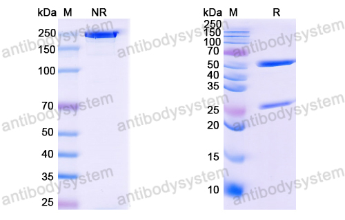 Anti-HCV NS1/gp68/gp70/Envelope glycoprotein E2 Antibody (B11)