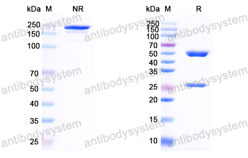 Anti-HCV NS1/gp68/gp70/Envelope glycoprotein E2 Antibody (D04)