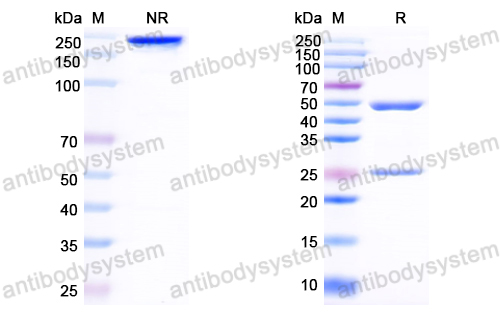 Anti-HCV NS1/gp68/gp70/Envelope glycoprotein E2 Antibody (3/11#)