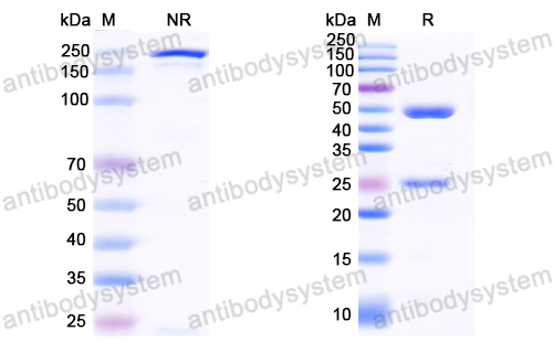 Anti-HCV NS1/gp68/gp70/Envelope glycoprotein E2 Antibody (A8)