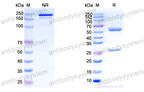 Anti-HCV NS1/gp68/gp70/Envelope glycoprotein E2 Antibody (L3)