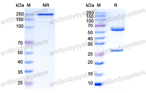 Anti-HCV NS1/gp68/gp70/Envelope glycoprotein E2 Antibody (L1)