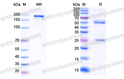 Anti-HCV NS1/gp68/gp70/Envelope glycoprotein E2 Antibody (1:11#)