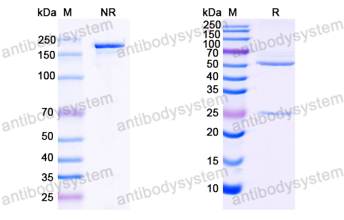 Anti-HCV NS1/gp68/gp70/Envelope glycoprotein E2 Antibody (1:5#)