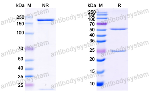 Anti-HCV NS1/gp68/gp70/Envelope glycoprotein E2 Antibody (C1)