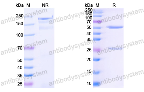 Anti-HCV NS1/gp68/gp70/Envelope glycoprotein E2 Antibody (AP33)