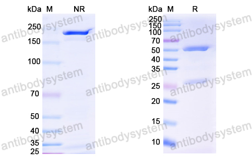 Anti-HCV gp32/gp35/Envelope glycoprotein E1 Antibody (IGH526)