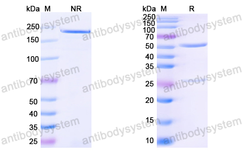 Anti-HPV16 L1/Major capsid protein L1 Antibody (H16.4G12)