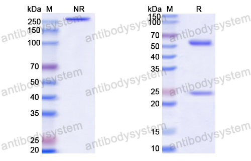 Anti-HCV Genome polyprotein Antibody (cVH-E2)