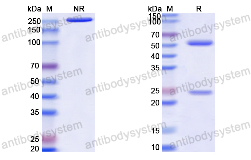 Anti-HCV Genome polyprotein Antibody (D32.10)