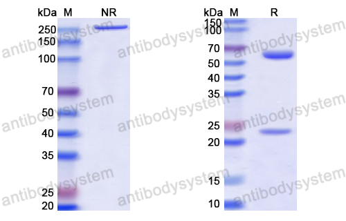 Anti-HCV Hepacivirin/NS3 helicase/NS3P/Viroporin p70 Antibody (41#)