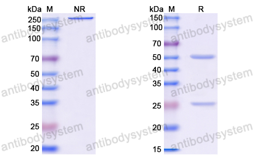 Anti-VSV G/Glycoprotein G Antibody (M31)