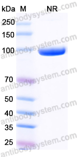 Anti-VSV NP/Nucleoprotein Antibody (1001)