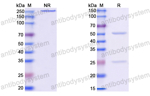 Anti-HBV-D HBcAg/C/p21.5 Antibody (E21#)