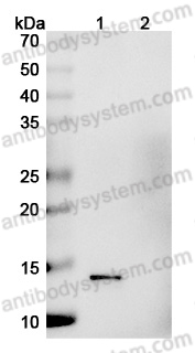 Anti-Vaccinia virus/VACV A27L Antibody (1G6)