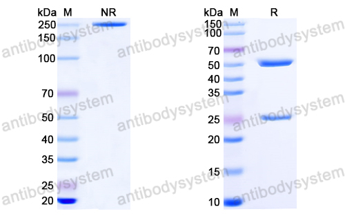 Anti-EBV/HHV-4 gH & gL Complex Antibody (E1D1)