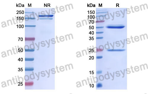 Anti-DENV-2 NS1 Antibody (DENV2P10)