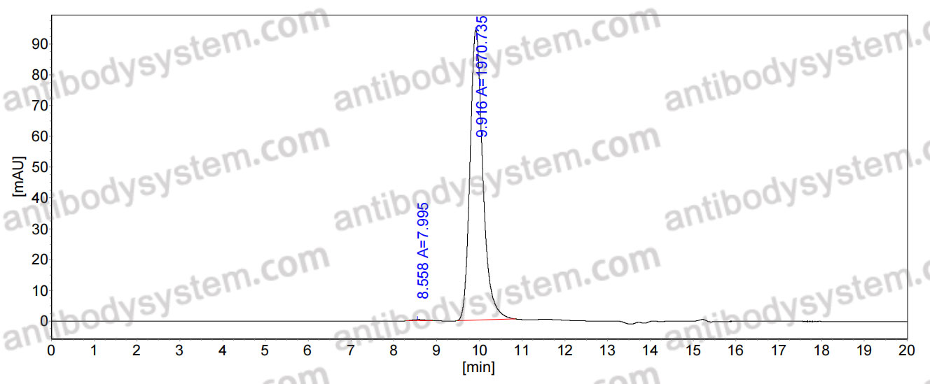 Anti-Coxsackievirus A16 Virion protein 1/VP1 Antibody (18A7)