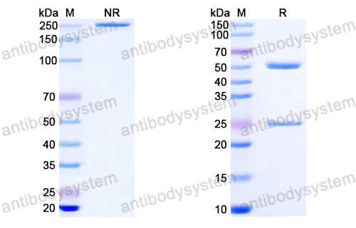 Anti-HIV-1 Matrix protein p17/MA protein Antibody (M33)