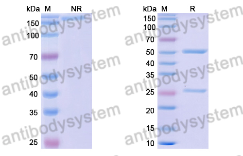 Anti-DENV-1 Envelope protein E Antibody (14c10)