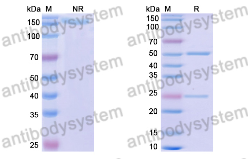 Anti-DENV-1 Envelope protein E/EDIII domain (CC loop) Antibody (E111#)