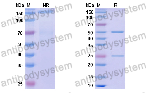 Anti-DENV-1 Envelope protein E Antibody (50-11E)