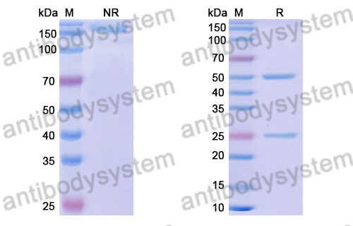 Anti-DENV-1 Envelope protein E Antibody (63-6C)