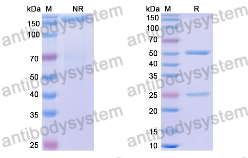 Anti-DENV-1 Envelope protein E Antibody (1F4)