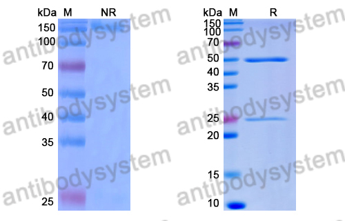 Anti-DENV-1 Envelope protein E Antibody (4E11#)