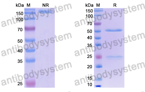 Anti-DENV-2 Envelope protein E/EDIII A strand Antibody (DV87.1)