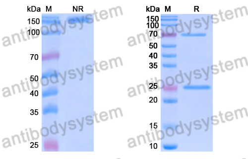 Anti-DENV-2 Envelope protein E/EDII fusion loop Antibody (DV82.11)