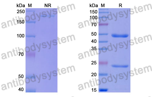 Anti-DENV-3 Envelope protein E/EDIII A strand Antibody (5J7)