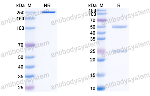 Anti-EBV/HHV4 gB/BALF4 Antibody (AMMO5)