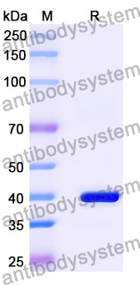 Anti-Sudan ebolavirus/SEBOV NP/Nucleoprotein Antibody (SAA1402)