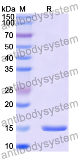 Anti-Influenza A virus RNA polymerase complex Nanobody (SAA1427)