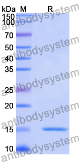 Anti-Bacteriophage H19B stxB/SLT-1b/VT1 Nanobody (7-2#)