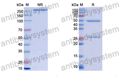 Anti-Suid herpesvirus 1/SuHV-1 UL42/PAP Antibody (2G11)