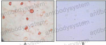 Anti-KSHV/HHV8 K8 Antibody (R4D75)