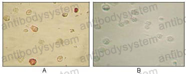 Anti-KSHV/HHV8 ORF45 Antibody (R4D76)