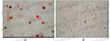 Anti-KSHV/HHV8 ORF62 Antibody (R4D77)