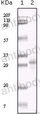 Anti-KSHV/HHV8 ORF26 Antibody (R4D78)