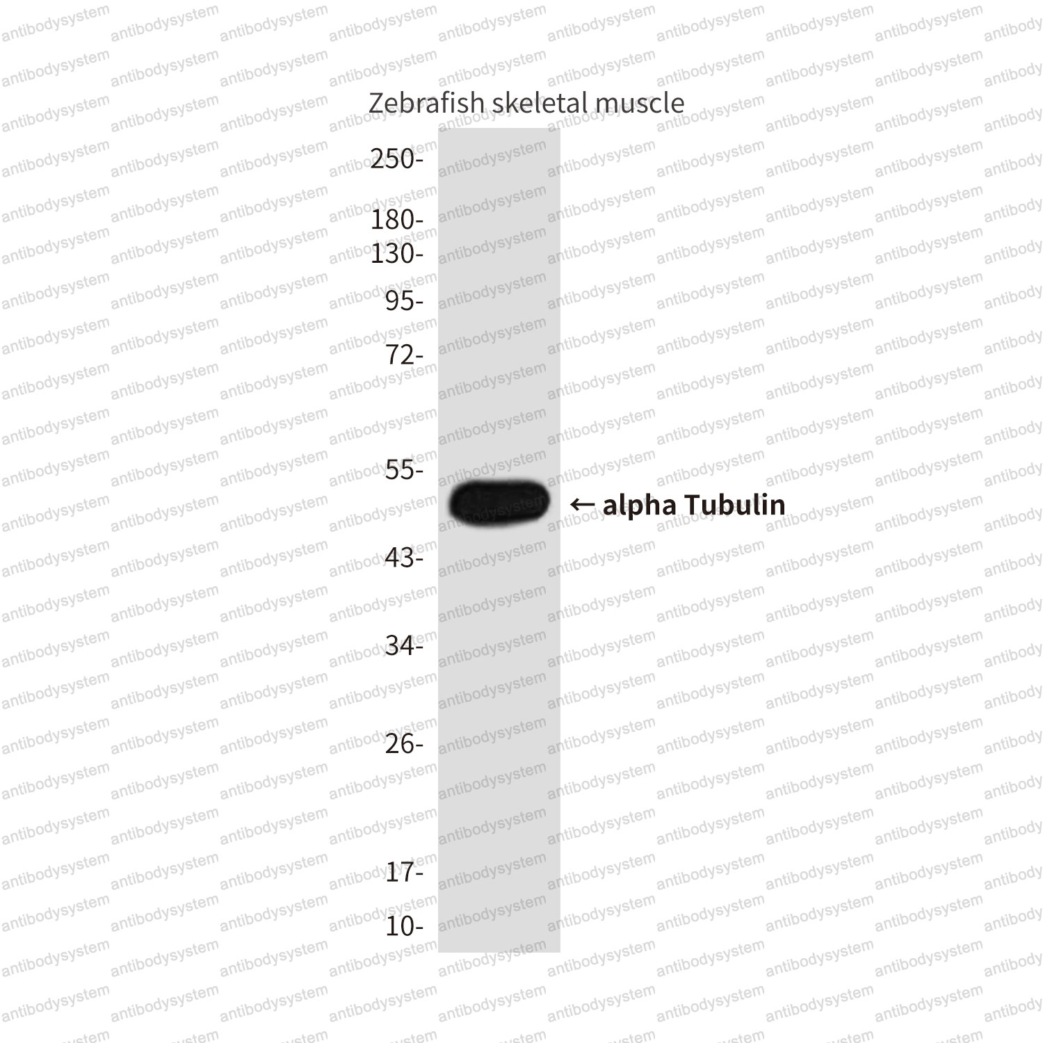 Anti-Alpha Tubulin Antibody (R3P42)